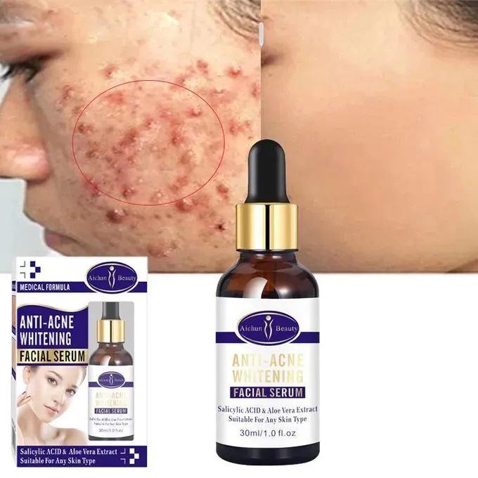 Aichun Beauty Glowing Remover Scars Facial Serum - 30ML - AC31952